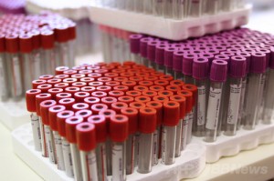 パリ市内にあるフランス血液機構（EFS）血液収集センターに並ぶ、血液検査用の試験管（2012年7月6日撮影、資料写真）。