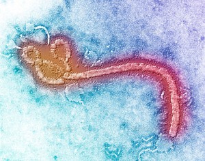 エボラウイルスは以下の5種の存在が確認されている。ザイールエボラウイルス、スーダンエボラウイルス（スーダンコートジボワールウイルス）、レストンエボラウイルス 、タイフォレストエボラウイルス（アイボリーコーストエボラウイルス）、ブンディブギョエボラウイルス。 