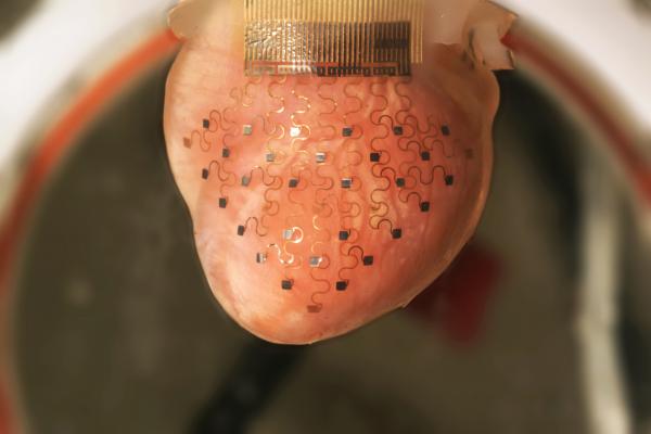 ３Dプリンターでプロトタイプ次世代心臓ペースメーカーが開発される！